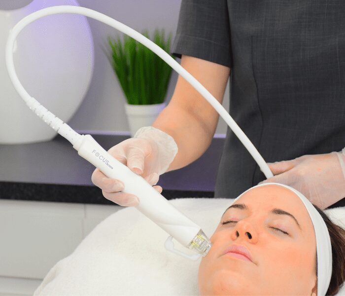 RF Microneedling Prices - Setsuko Beauty Clinic