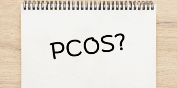 Laser hair removal for PCOS