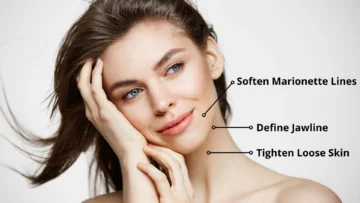 HIFU Facial facelift Treatment areas