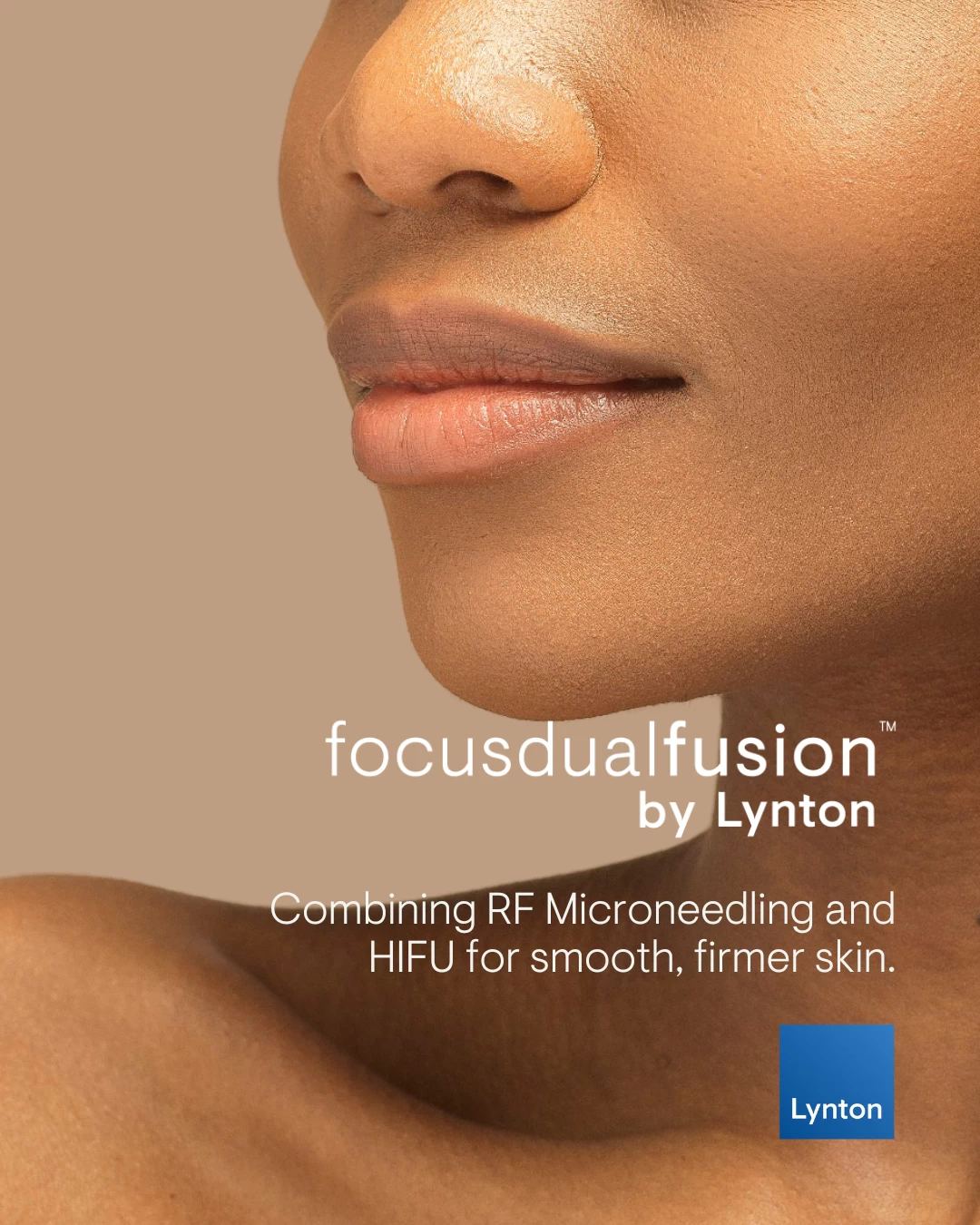 FocusDual Fusion Combined RF Microneedling and HIFU